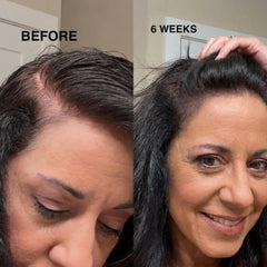 Innerbloom minoxidil application on scalp demonstrating targeted treatment.