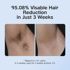 INNZA IPL manual mode used for small, precise areas like upper lip