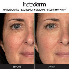 Instaderm Anti-Aging Resurfacing Pads being applied for a refreshing, smooth feel