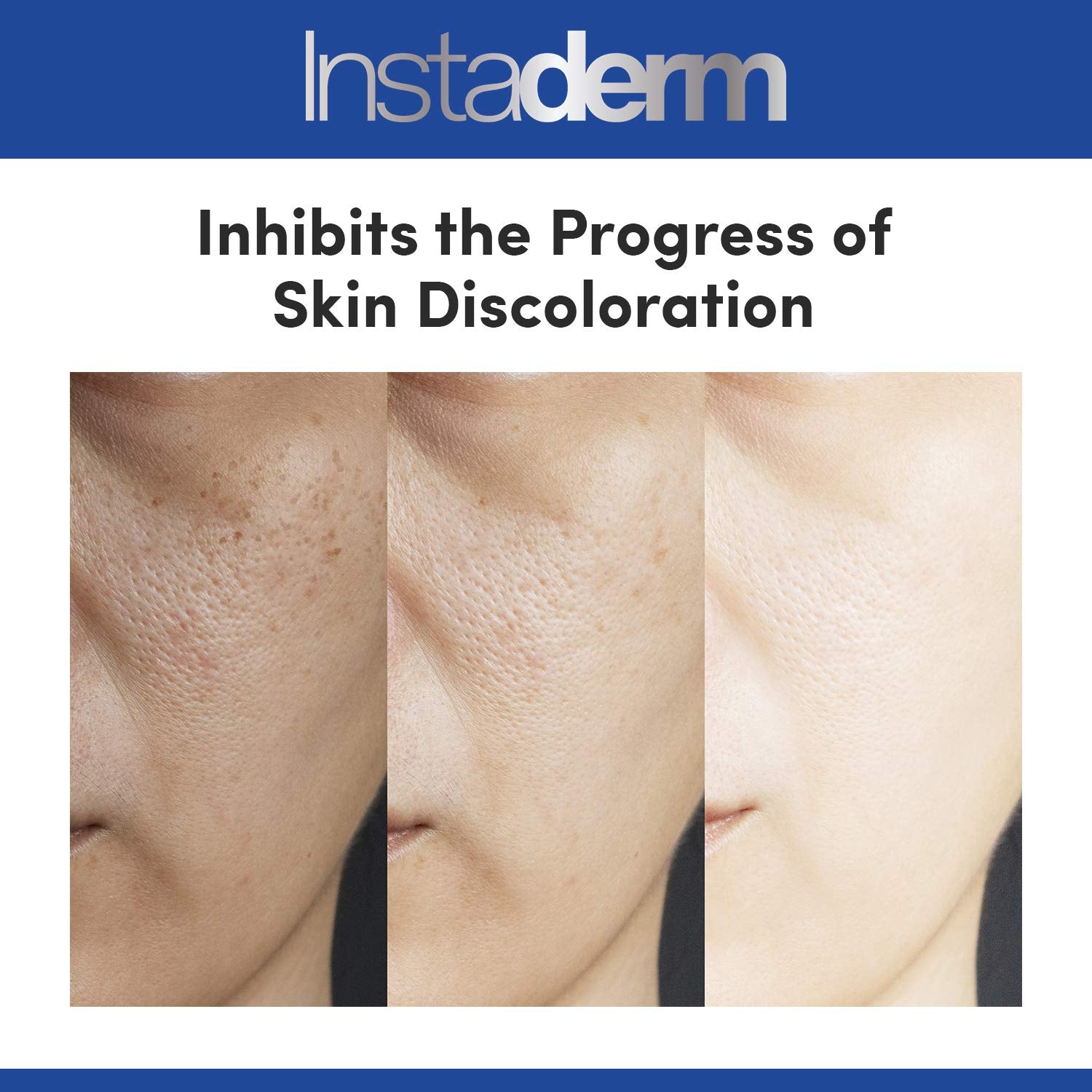 Instaderm hydrated glow on skin after application.