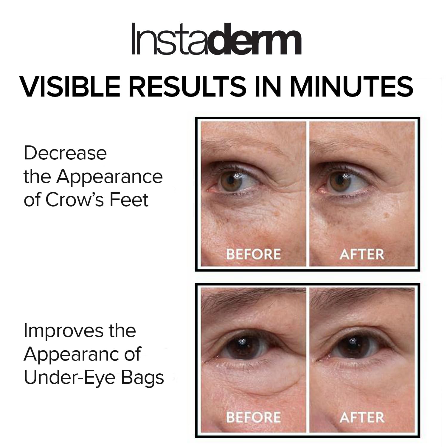 Instaderm Instant Eye Tightener applied under-eye demonstrates quick smoothing.
