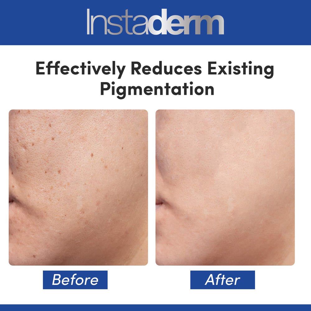 Instaderm clean packaging ready for daily skincare routine.