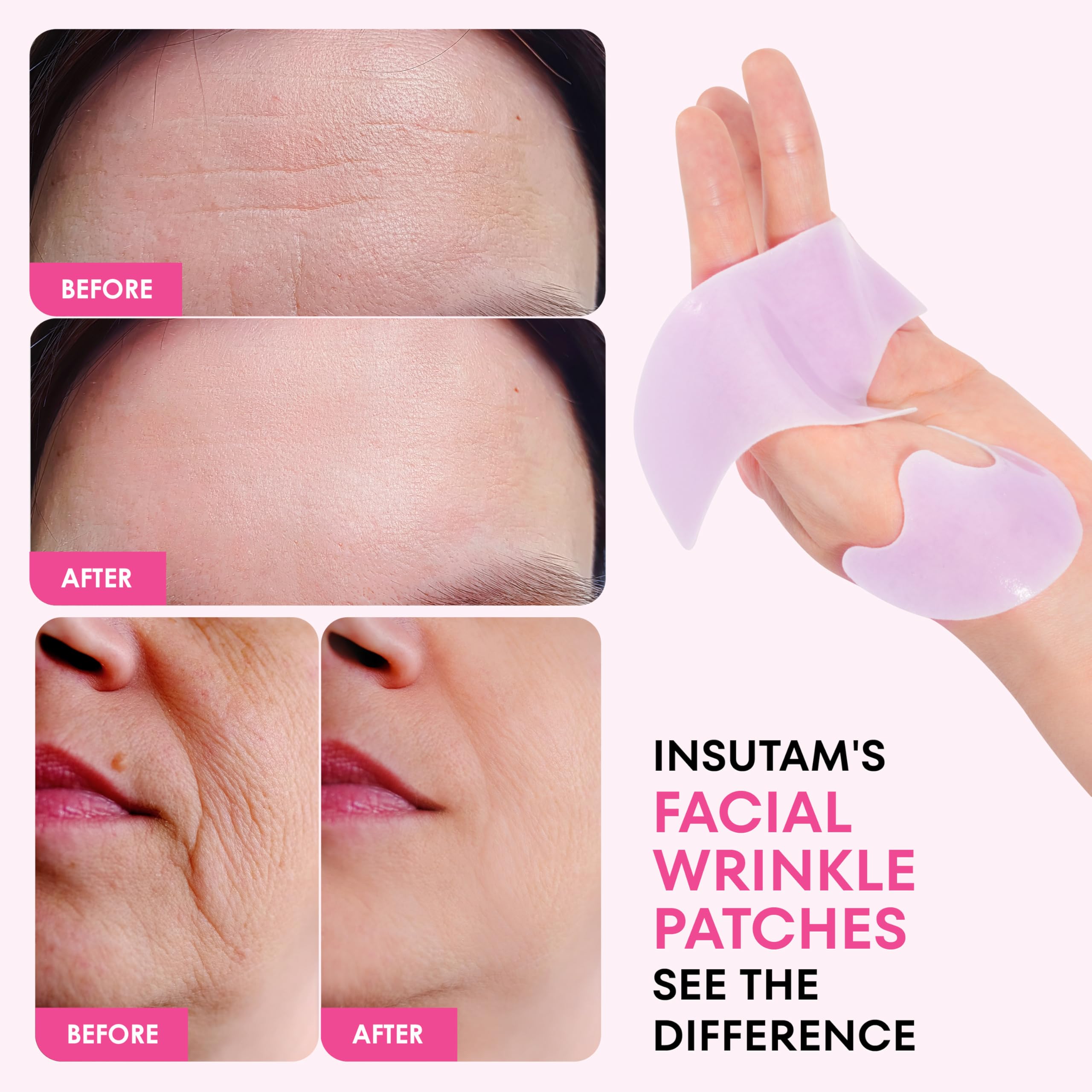 Insutam patch worn near smile lines showing gentle tightening.