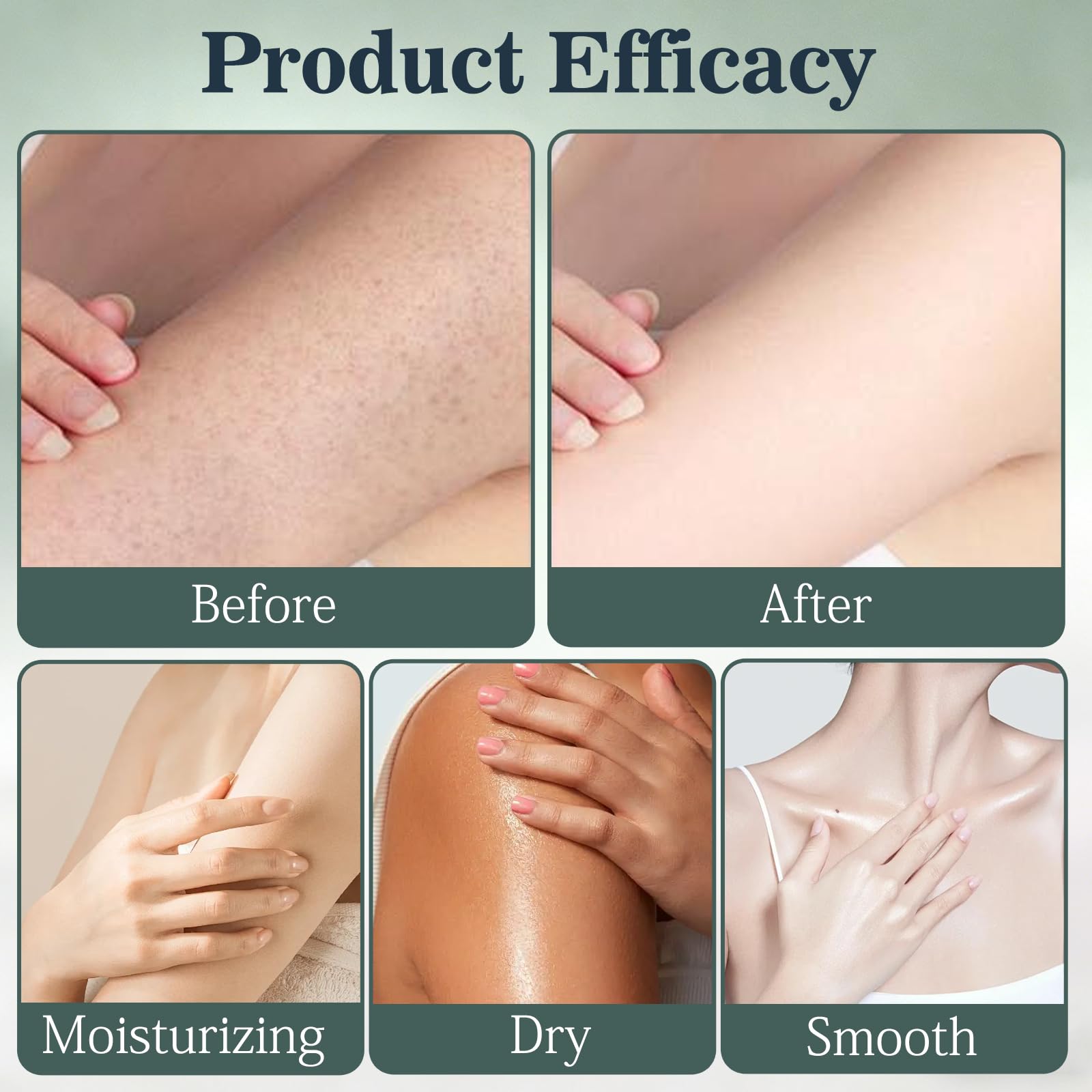 2-ounce Intertrigo Relief Cream bottle is travel-friendly.