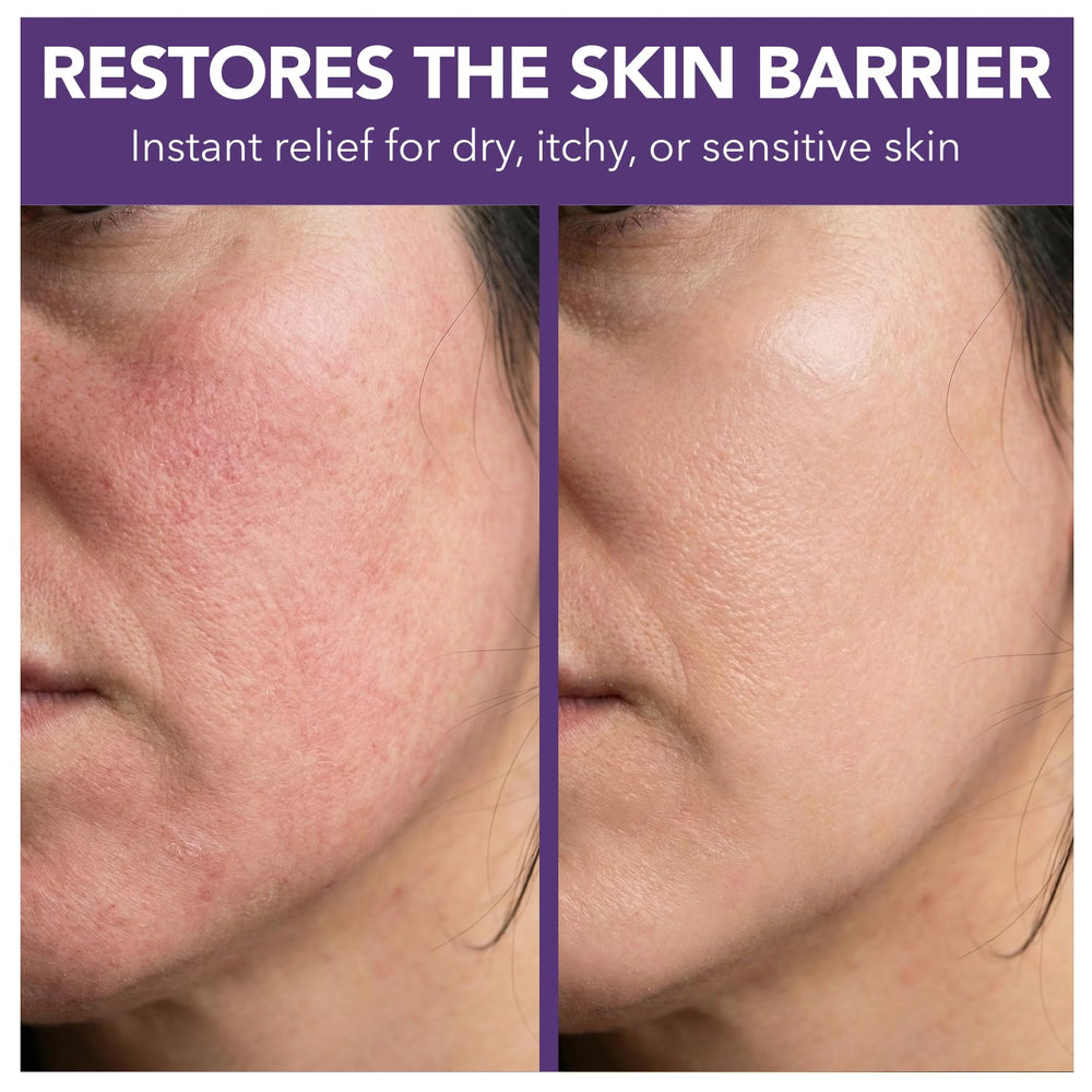 Intimate Rose unscented balm for dry, sensitive skin.