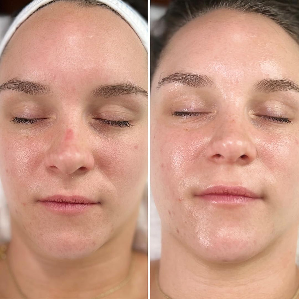 Intraceuticals Rejuvenate Daily Serum creates makeup-ready, hydrated skin.