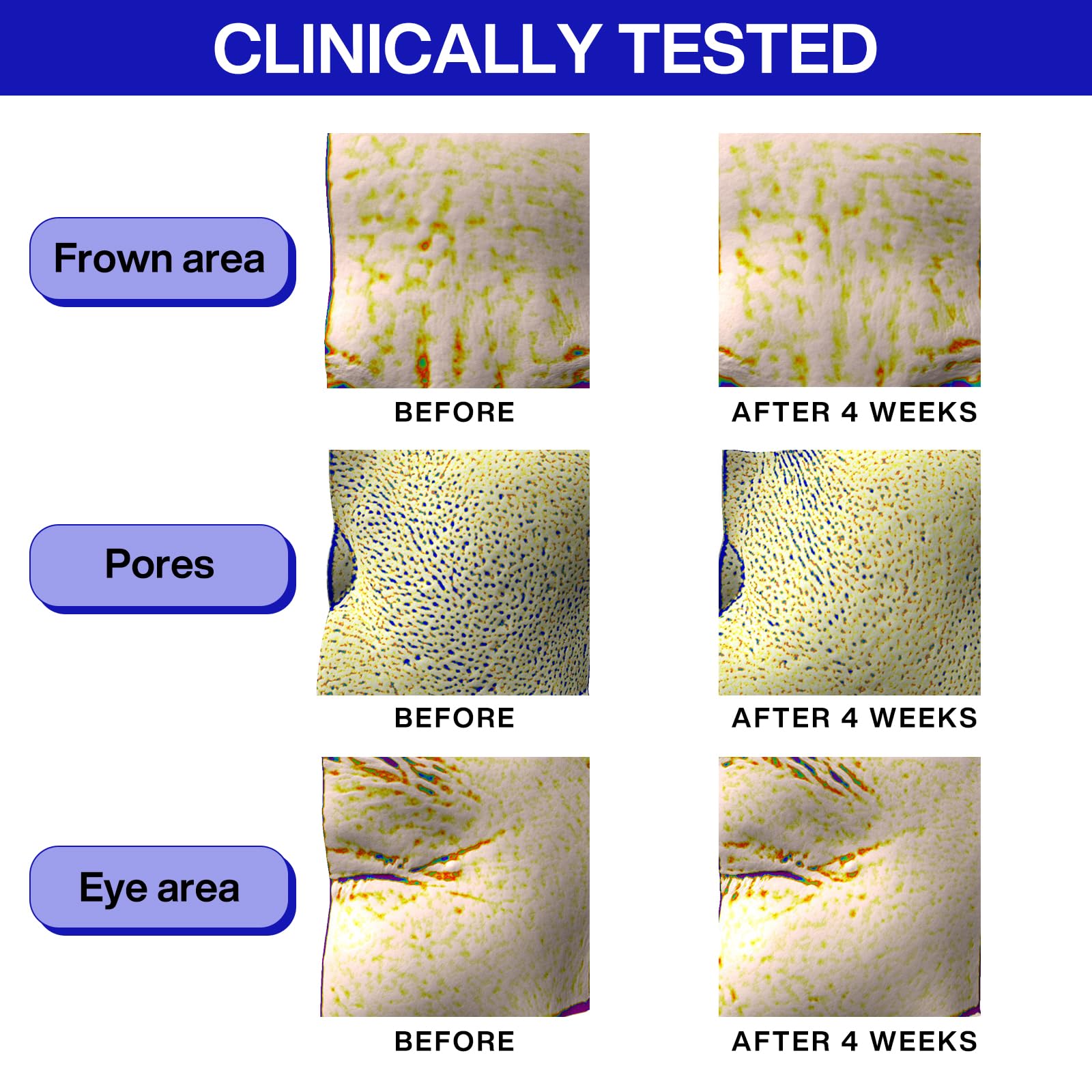 IOPE one-week results concept showing improved elasticity