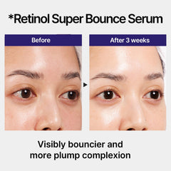 IOPE Retinol Retinoid Quadruple Complex graphic highlights advanced retinoid blend