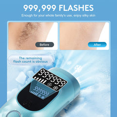 Iouniya Manual Mode allows precise bikini or facial use.
