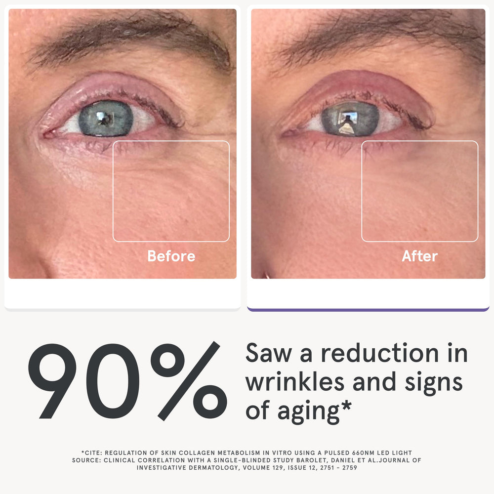 irestore eye mask focuses light on the forehead 11s area.