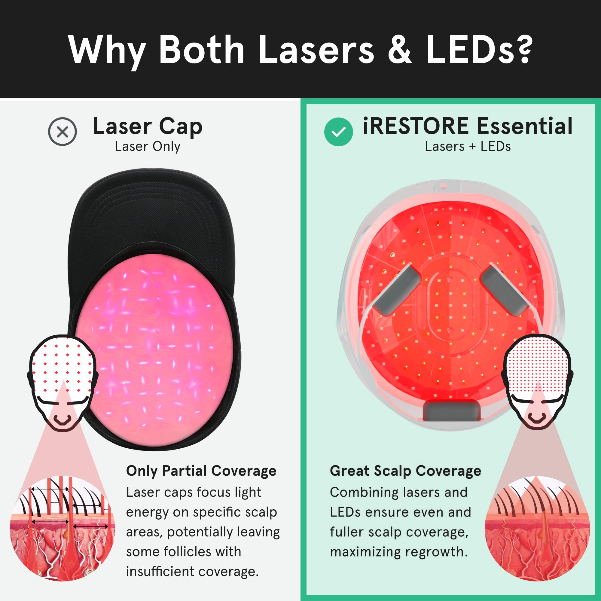 iRestore delivers potential hair growth support within your home routine.