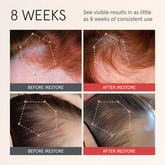 iRestore Scalp Serum dropper applying product to scalp for quick absorption.