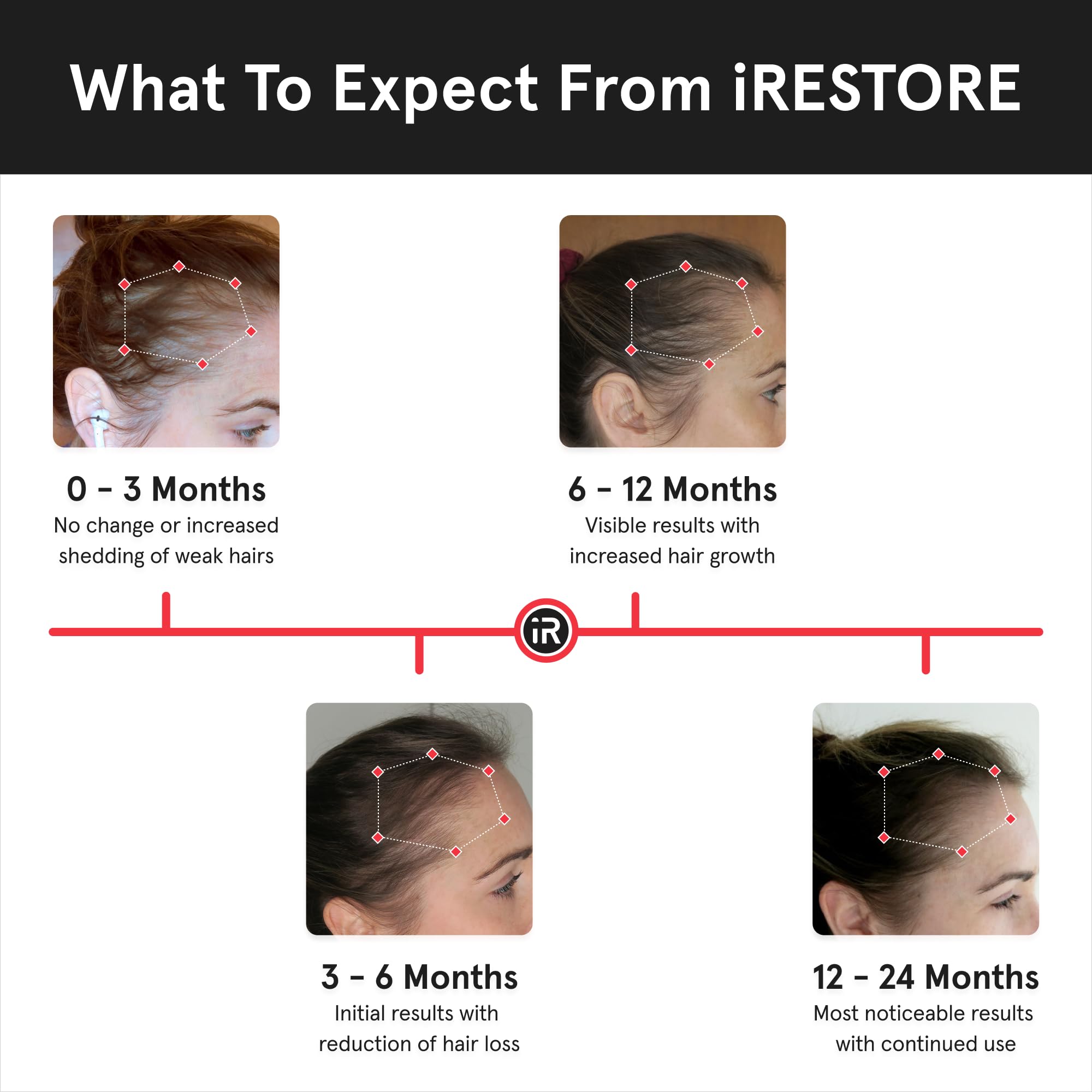 iRestore Essential in operation during a typical 20-minute session for thinning areas.