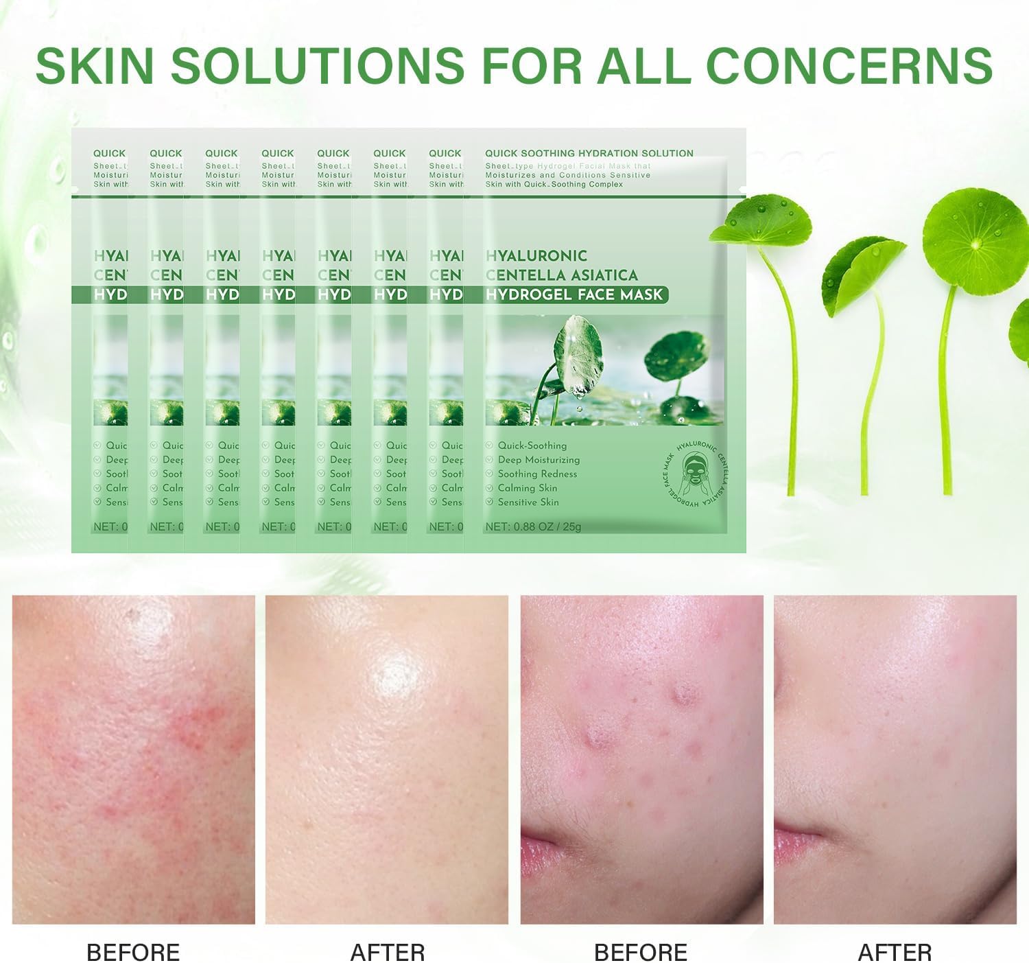 IREV Calming Mask application on face showing immediate calm.