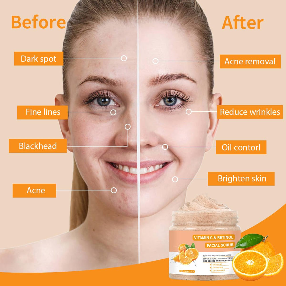 IREV exfoliating scrub texture shows gentle exfoliation.