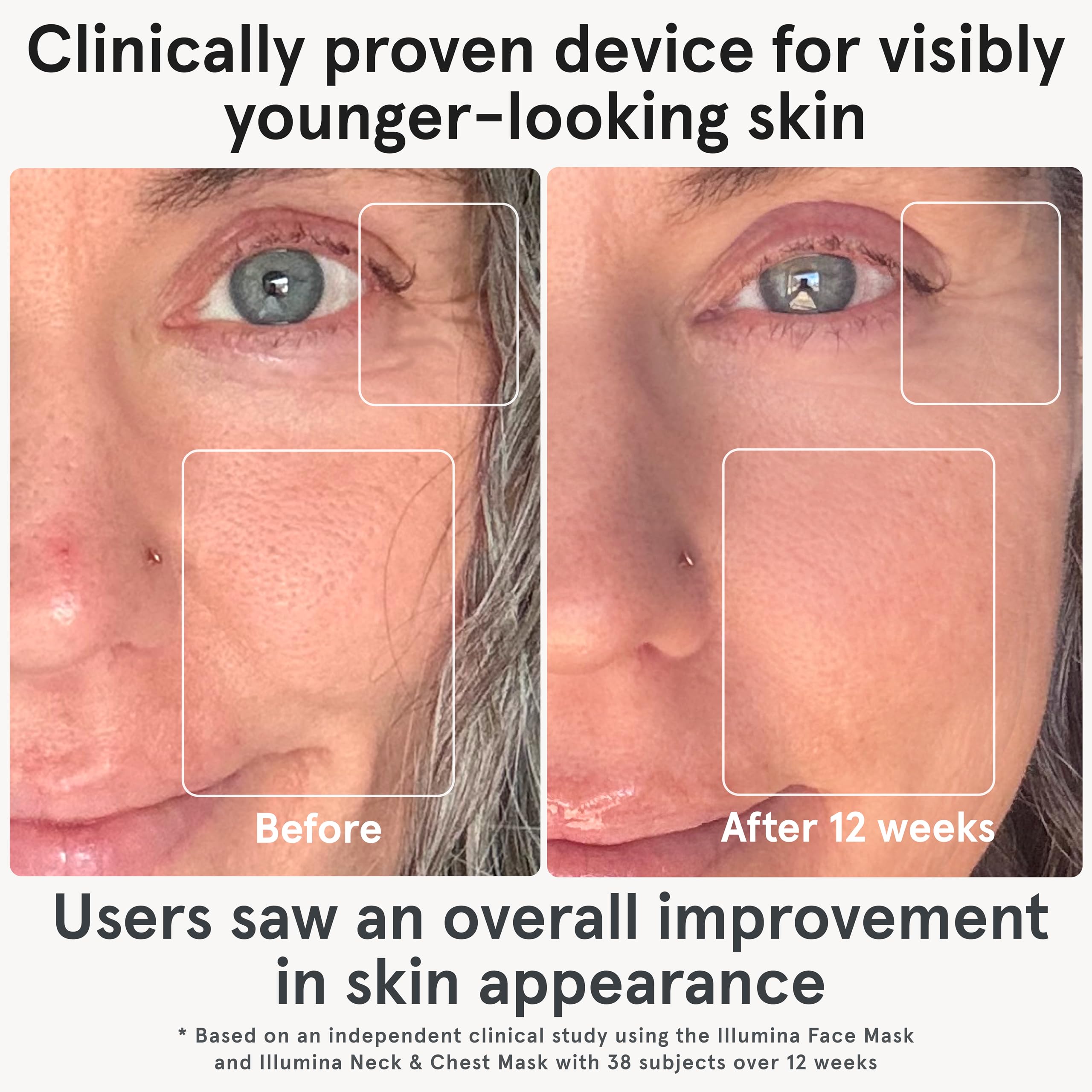 iRestore LED mask uses red blue infrared wavelengths for targeted skin goals