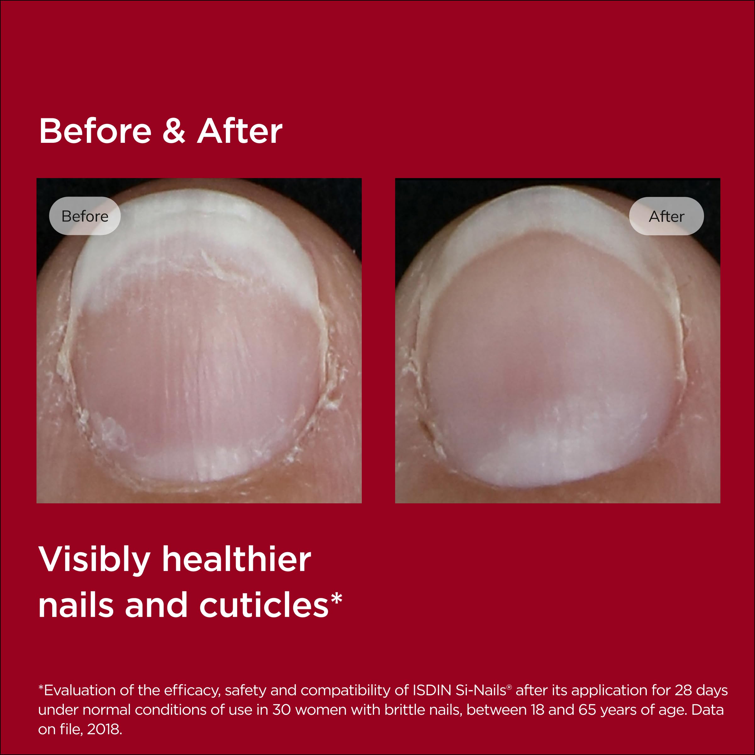 ISDIN Si-Nails cuticle moisturization supports healthier surrounding skin