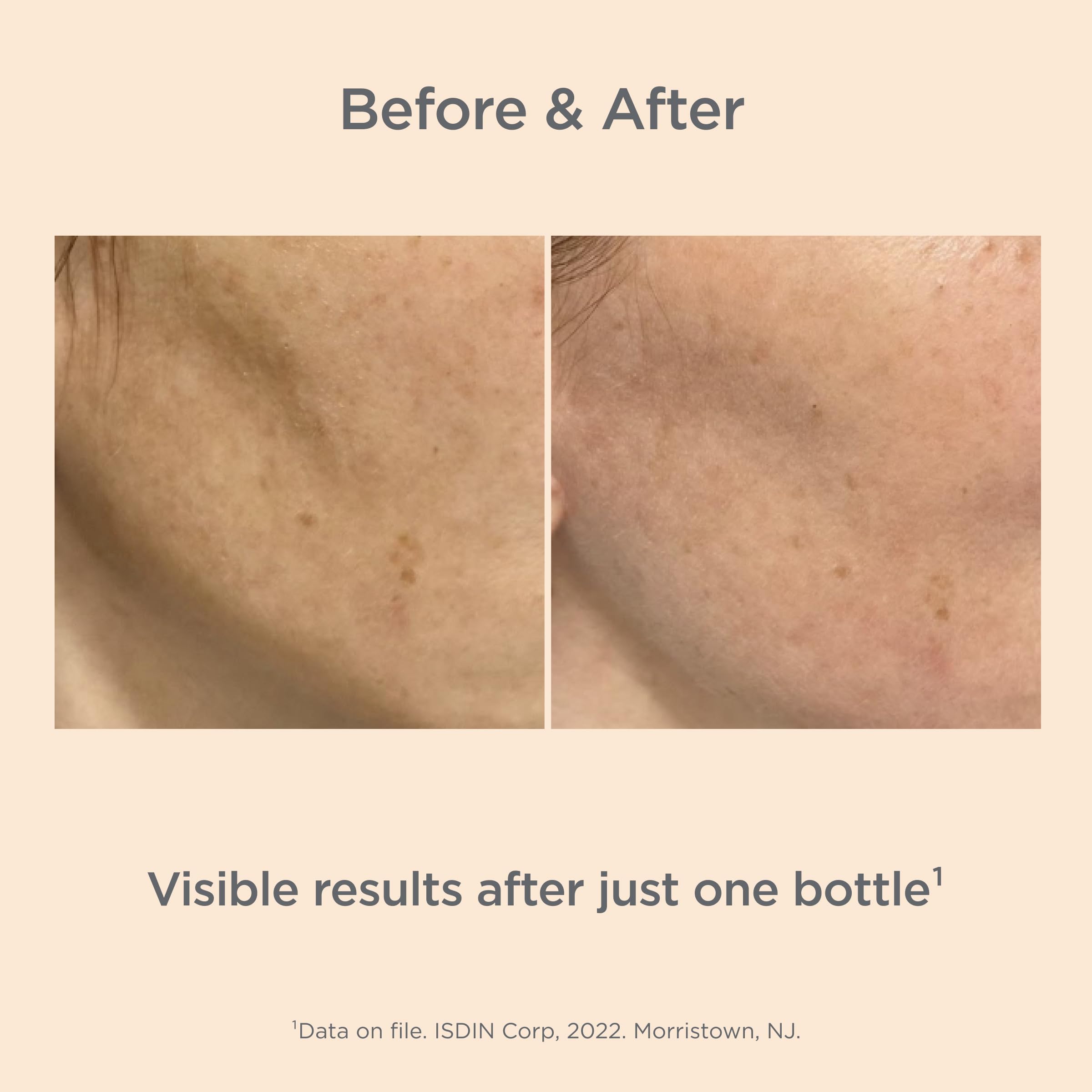 ISDIN Melaclear Advanced demonstrates even skin tone potential in daily care