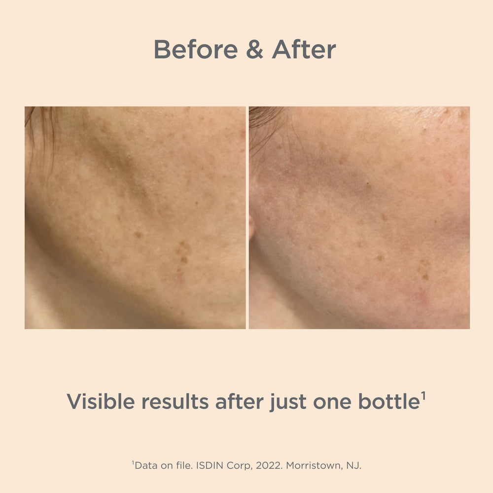 ISDIN Melaclear Advanced demonstrates even skin tone potential in daily care
