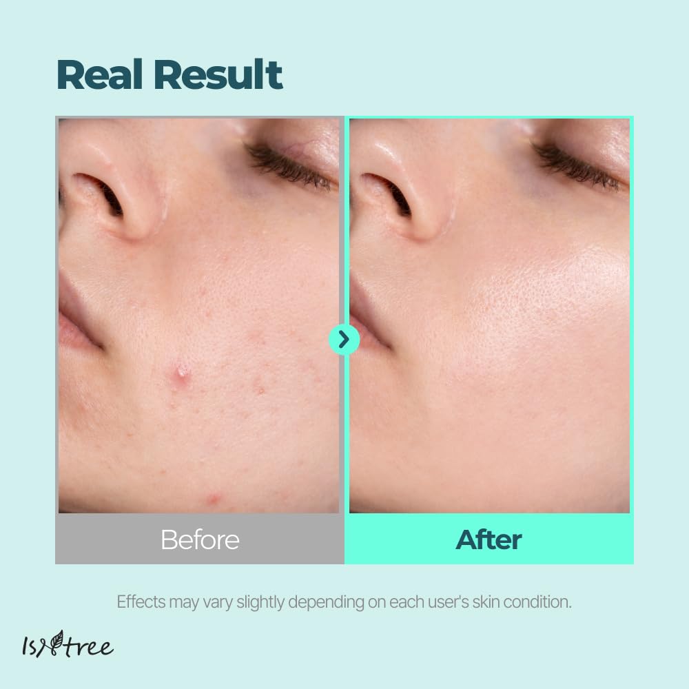 isntree gim pdrn deep sleep mask translucent glow and skin bounce by morning