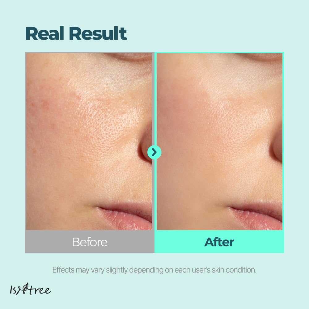 ISNTREE Gim PDRN Hydro Bouncy Ampoule provides a dewy, glowing finish.