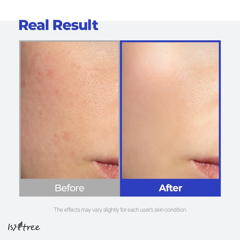 IsNtree Hyaluronic Acid Aqua Gel Cream shown in a morning skin routine