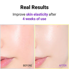 IsNtree Hyper Retinol EX 1.0 serum ingredients list highlights a balanced retinol blend.