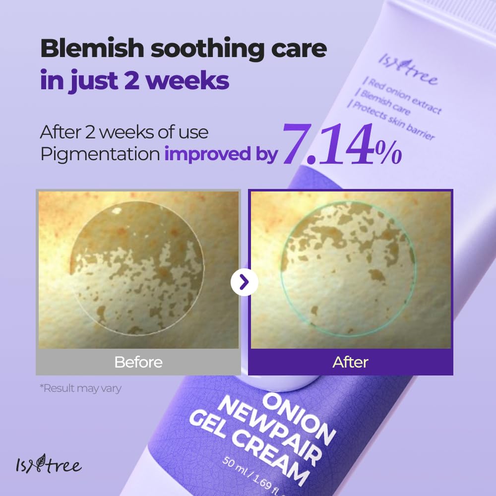 IsNtree Onion Newpair contains 71 percent red onion extract for nourishing care