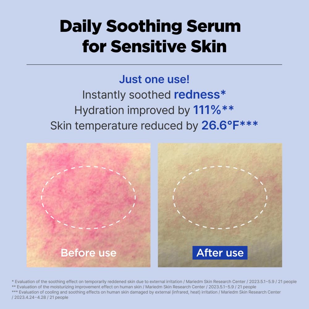 ISOI ACNI Dr. 1st Control Serum dropper close-up for precise application