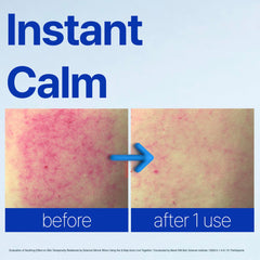 ISOI ACNI Dr. 1st Speedy Gel Cream closeup texture absorbs quickly