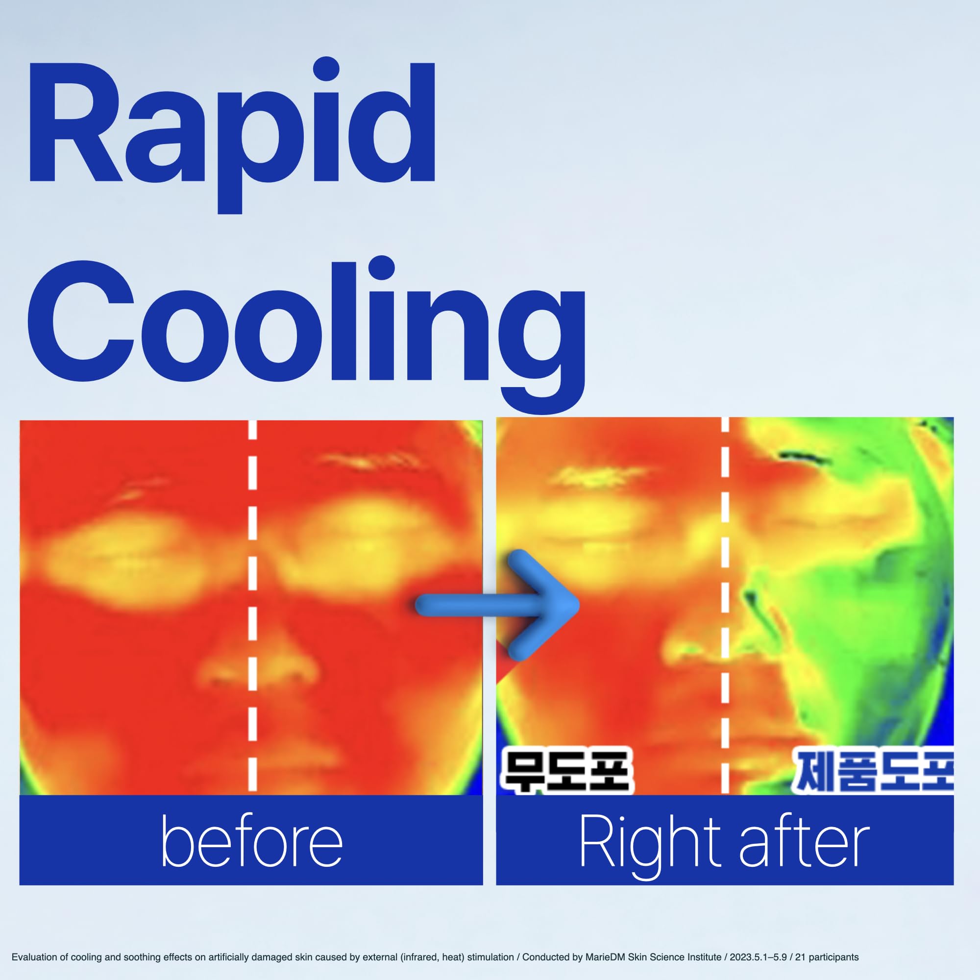 ISOI ACNI Dr. 1st Speedy Gel Cream on skin application cools and hydrates