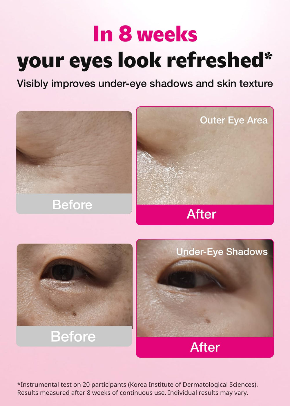 ISOI blemish care under-eye patch texture shows cooling hydration for tired eyes