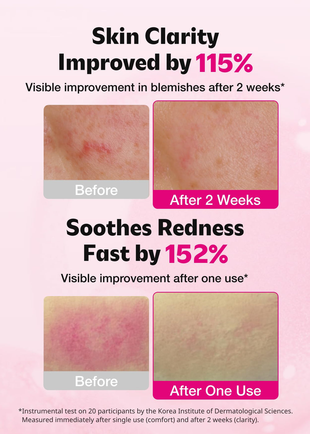 ISOI Blemish Care Up Serum texture closeup highlights lightweight gel for sensitive skin.