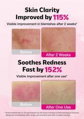 ISOI Blemish Care Up Serum texture closeup highlights lightweight gel for sensitive skin.