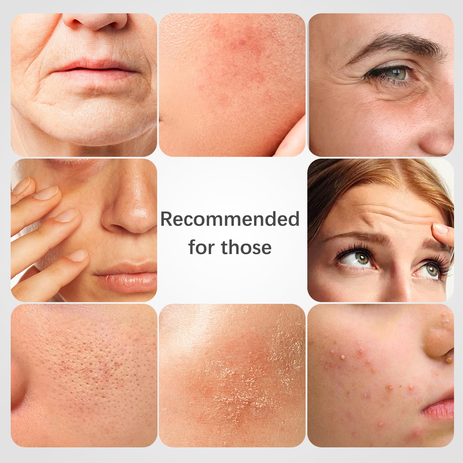 ISTON rosehip mask brightens tone with antioxidants.