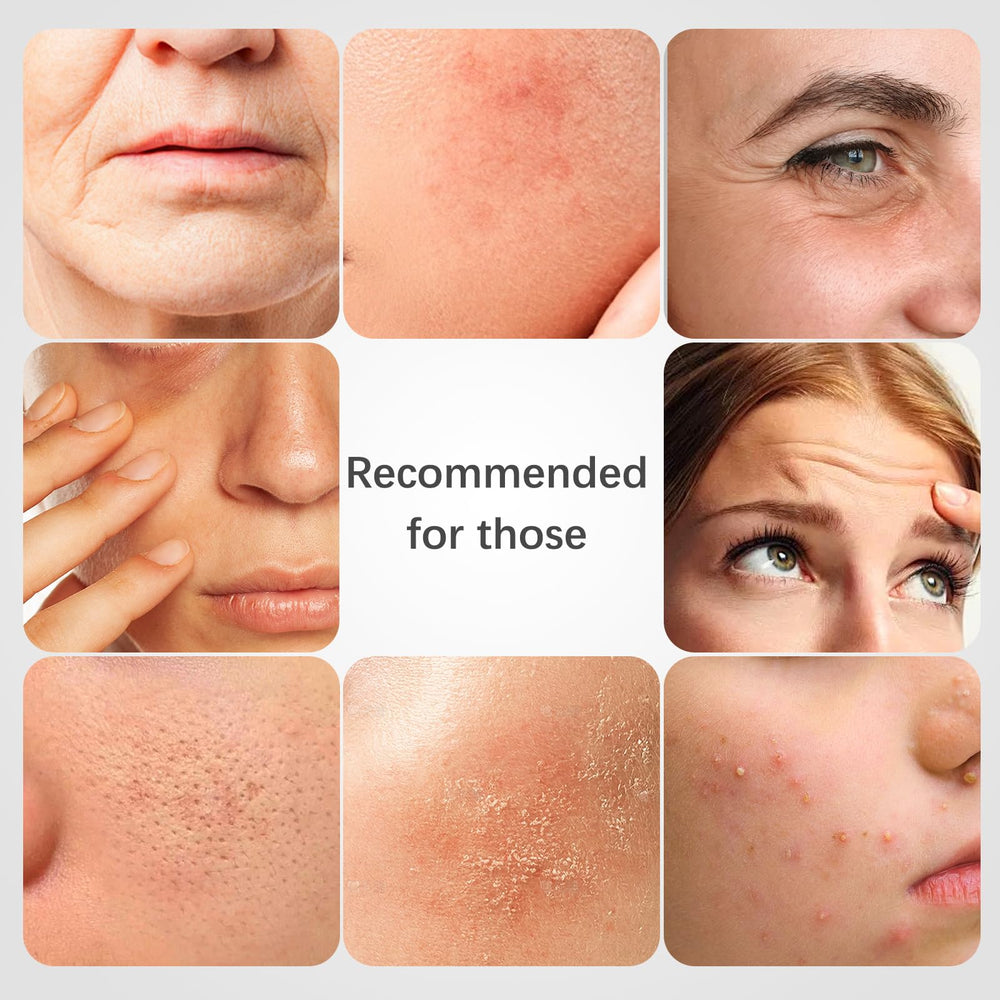 ISTON rosehip mask brightens tone with antioxidants.