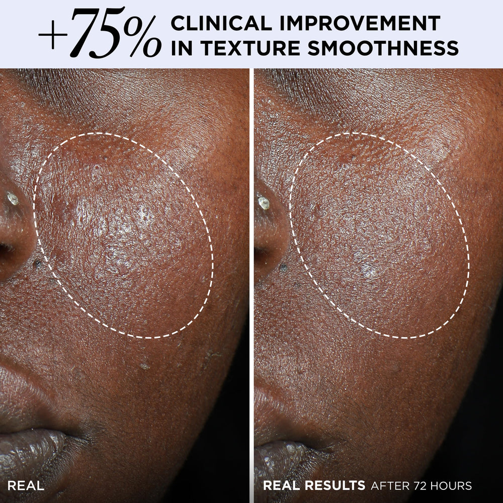 Confidence in a Cream Barrier Boost ingredients include ceramide and vitamin F for barrier support