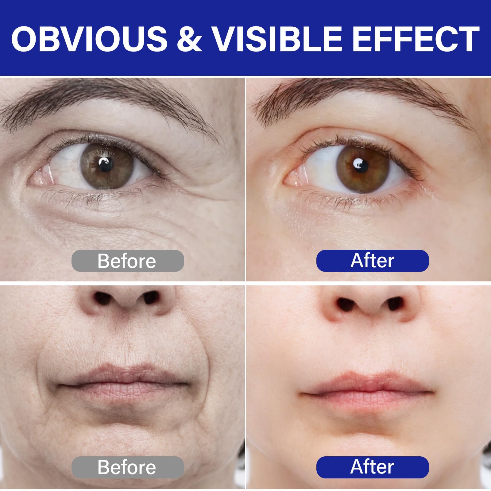 ITECFREELY PDRN Serum features 50 peptide types for plumpness and resilience.