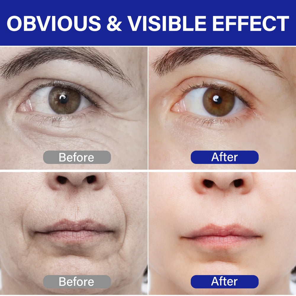 ITECFREELY PDRN Serum features 50 peptide types for plumpness and resilience.