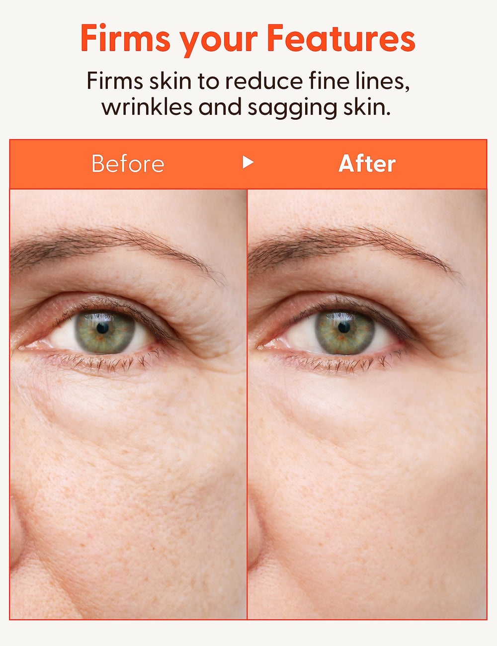 Its Skin Collagen Nutrition Emulsion anti-pollution formula protects skin daily.