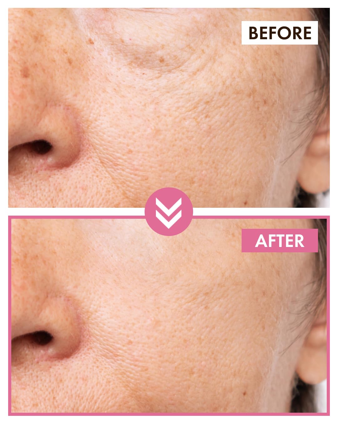 It's Skin Peptide Collagen Toner applied to skin for refreshed texture