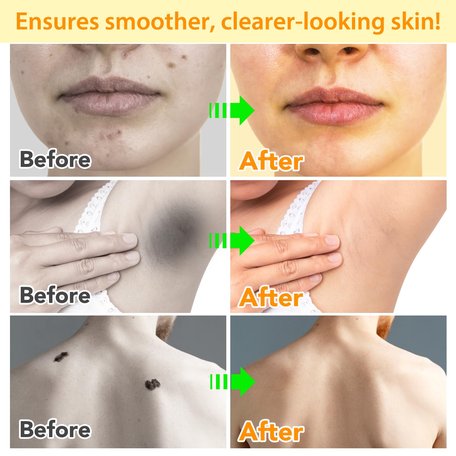 ITSDAWN Bee Venom Cream ingredient focus with bee venom nourishes skin.