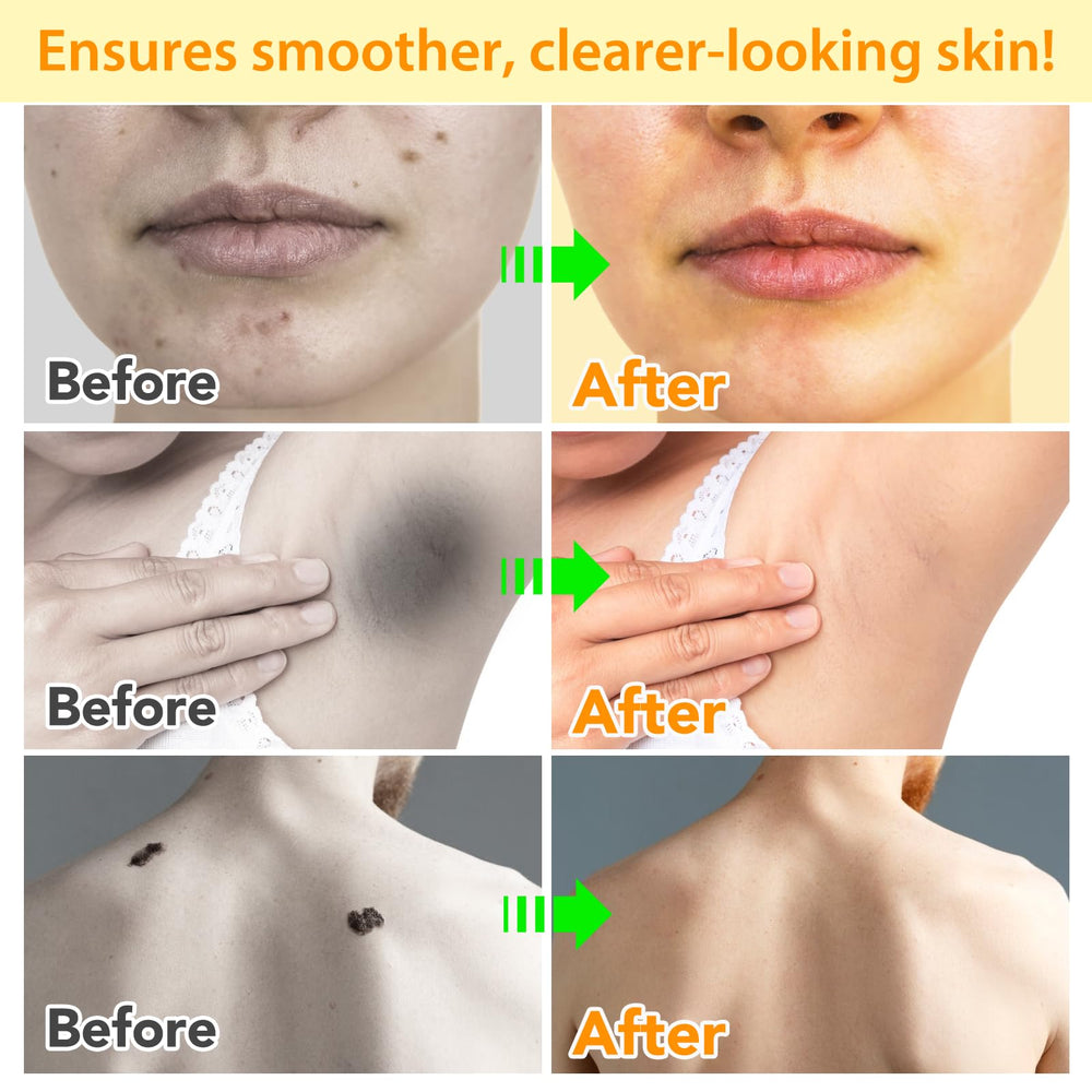 ITSDAWN Bee Venom Cream ingredient focus with bee venom nourishes skin.