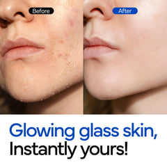 IVOSKIN Rice Milky Bubble Mask close-up shows gentle exfoliation