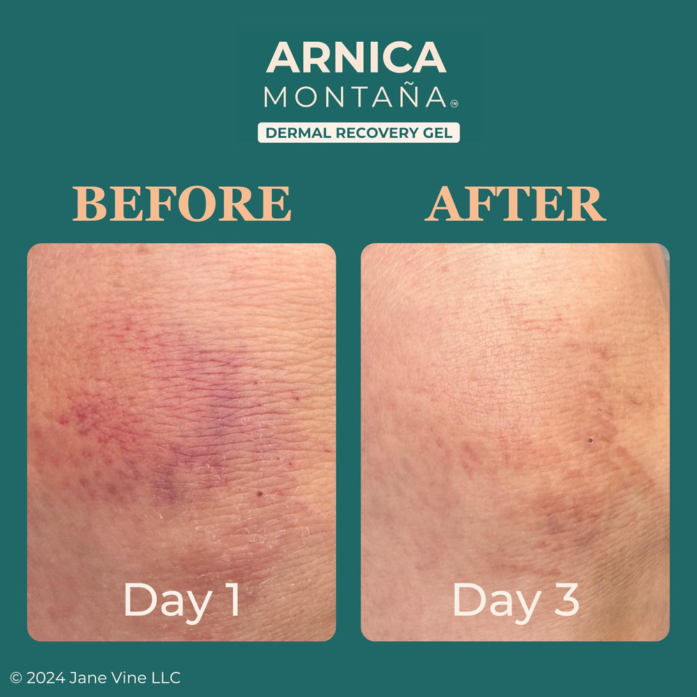 Jane Vine Arnica Gel texture swatch shows light, fast-absorbing consistency.