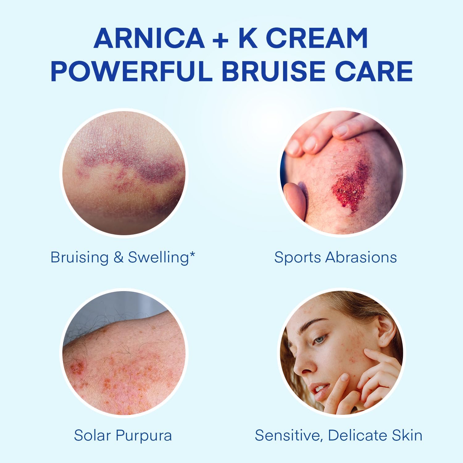 Jardient Arnica Bruise Cream jar open showing creamy, hydrating texture