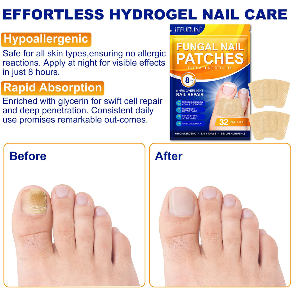 Jebiue strengthening nail treatment improving texture during use