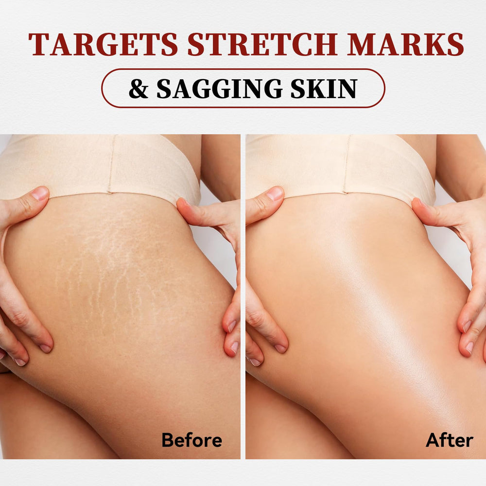 Jeirrzi Magic Body Oil non-comedogenic-formula is suitable for all skin types