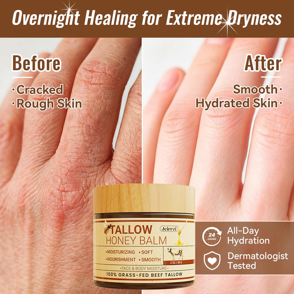 Jeirrzi winter weather skin care suits harsh outdoor conditions.