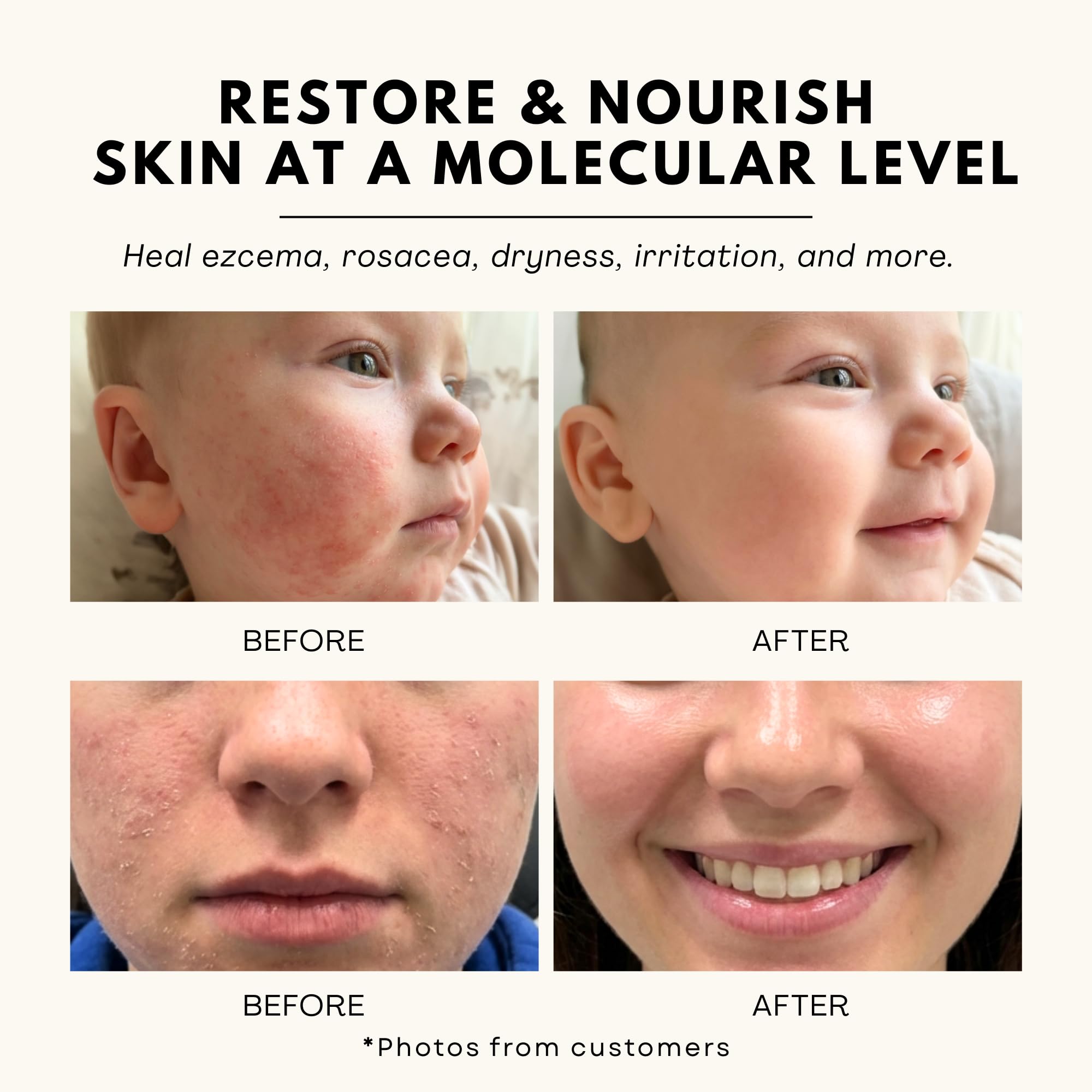 Jeune Jolie whipped tallow body balm delivers long-lasting moisture.